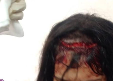 حمله ی هولناک سگ های ولگرد به کودک پنج ساله مسجدسلیمان