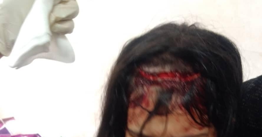 حمله ی هولناک سگ های ولگرد به کودک پنج ساله مسجدسلیمان