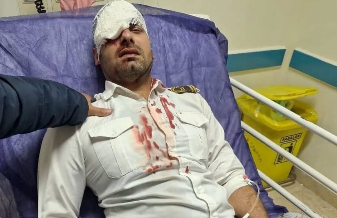 چاقوی همراه بیمار،بینایی چشم نیروی حراست بیمارستان ۲۲ بهمن مسجدسلیمان را گرفت