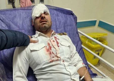 چاقوی همراه بیمار،بینایی چشم نیروی حراست بیمارستان ۲۲ بهمن مسجدسلیمان را گرفت